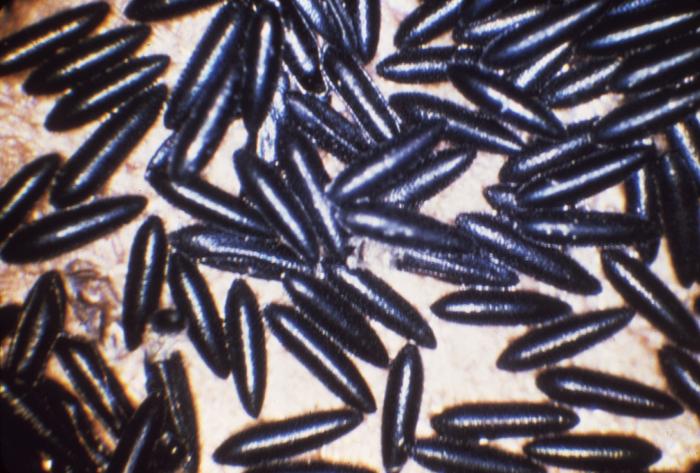 Ovos de Aedes aegypti vistos de perto, pequenos e alongados